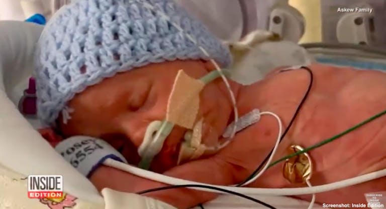 preemie, NICU
