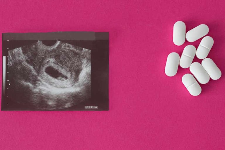 abortion-pill-ultrasound-pink-background-girl