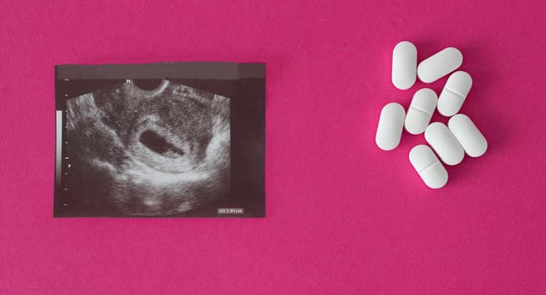 abortion-pill-ultrasound-pink-background-girl