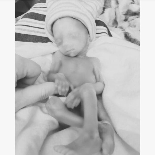 Photo courtesy of Jessica Spradlin (Kailor, born at 22 weeks, four days) Photo courtesy of Jessica Spradlin (Kailor, born at 22 weeks, four days)