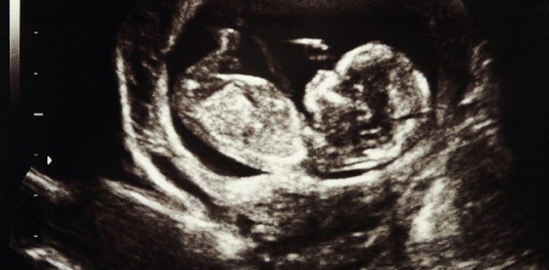 fetal tissue