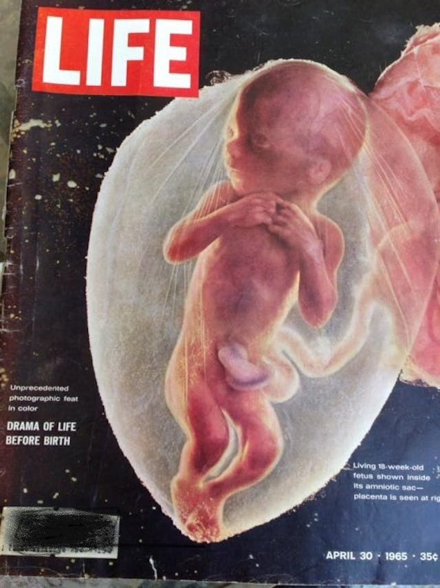 Life Magazine cover 1965. A 1950s photo of an 18-week preborn baby isn’t political. It’s proof of humanity. image