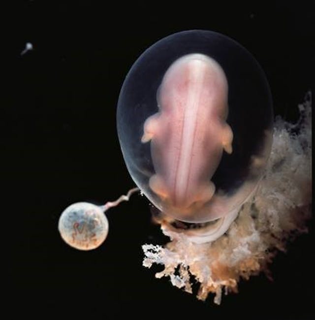 Embryo, 1965 by Lennart Nilsson. Photo via Facebook. A 1950s photo of an 18-week preborn baby isn’t political. It’s proof of humanity. image