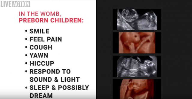 New Live Action video debunks claim, ‘No One Knows When Life Begins’ image