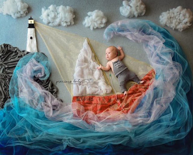 ‘Worthy of our love’: Photographer creates jawdropping photos of babies with medical needs image