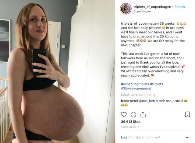 Parents of triplets: Doctor wanted us to have selective reduction abortion image