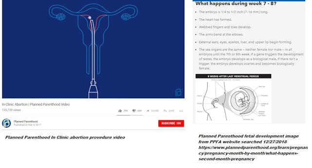 Image: Planned Parenthood in clinic abortion shows baby as dot v 7 to 8 week pregnancy