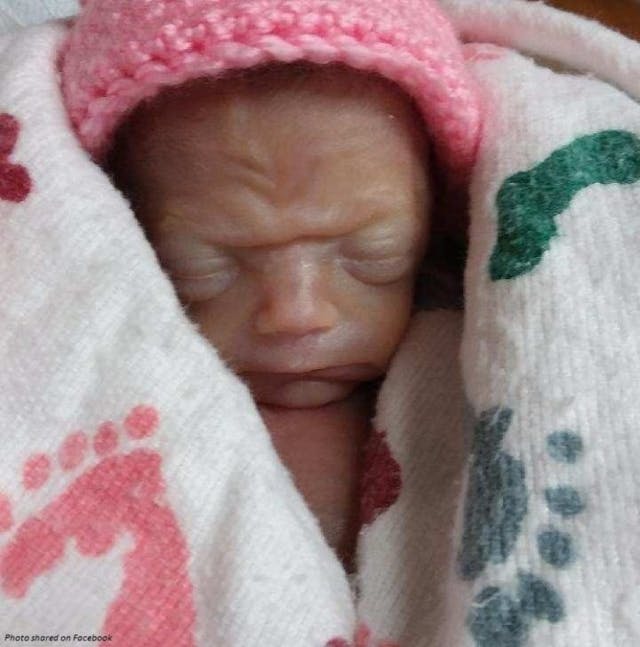 22-week preemie gasps, dies in mother’s arms as she begs hospital to help image