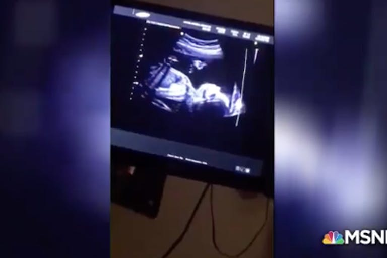 katy-tur-pregnancy-ultrasound