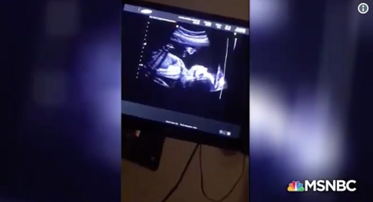 katy-tur-pregnancy-ultrasound