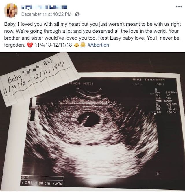 Parents respond to mom rationalizing her abortion: Life is the ‘best choice’ image