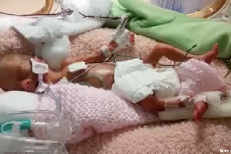 preemie, premature baby