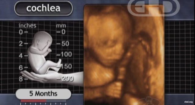 late-term abortionist, second trimester