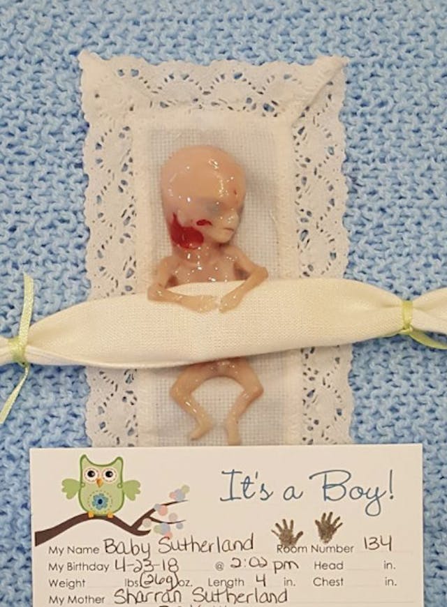 Baby Miran (Sharran Sutherland Facebook) miscarried, miscarriage, 14 weeks