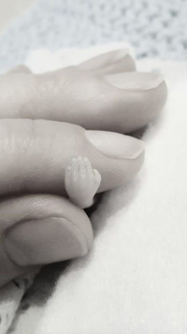 Miran’s hand (Sharran Sutherland Facebook) miscarried, miscarriage, 14 weeks