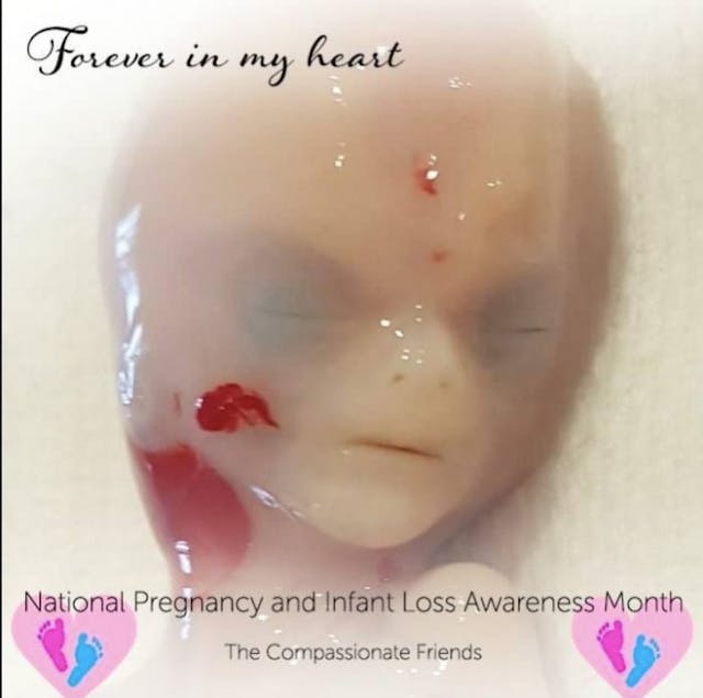 Sharran Sutherland Facebook miscarried, miscarriage, 14 weeks