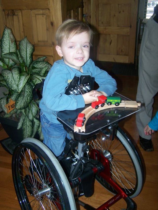 UK doctors perform first in-utero surgeries on babies with spina bifida image