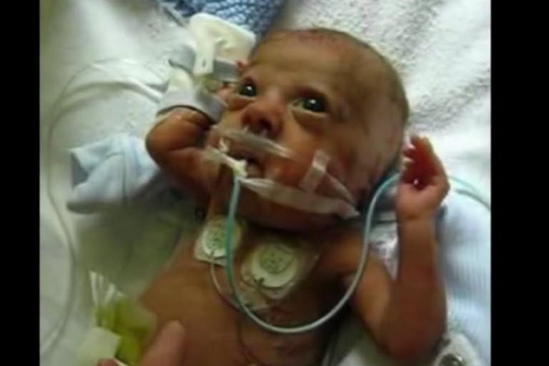 preemie, abortionist