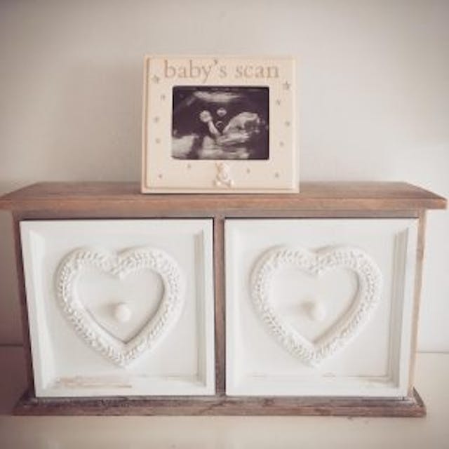 Baby Freya’s ultrasound. via Facebook