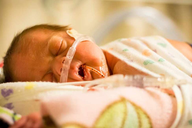 Premature baby sleeping Close up of a premature baby sleeping in a hospital.
