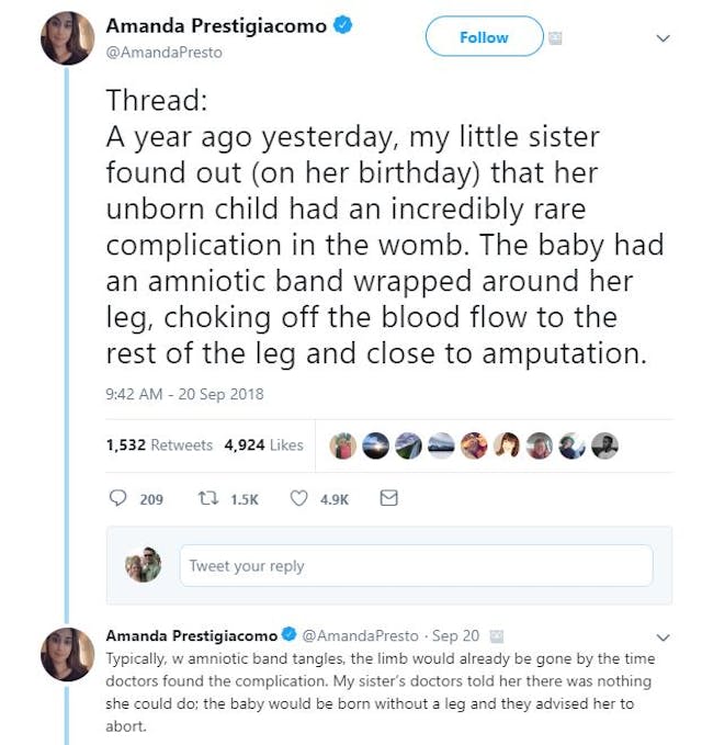 Prestigiacomo shared the story of her sister refusing abortion. Prestigiacomo shared the story of her sister refusing abortion.