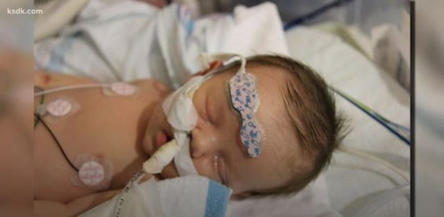 Jack became the first baby with half a heart to receive a heart and lung transplant Baby with half a heart defies odds after doctors refuse to help him image