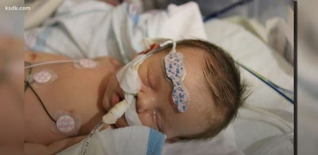 Baby with half a heart defies odds after doctors refuse to help him image