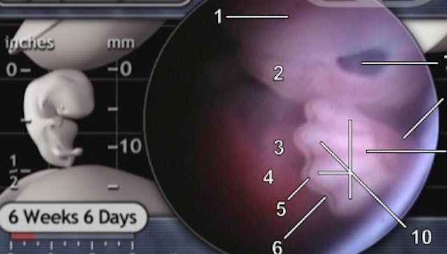 Even an ‘early abortion’ kills a human being… a remarkably developed one image