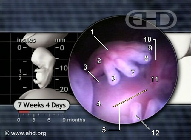 Even an ‘early abortion’ kills a human being… a remarkably developed one image