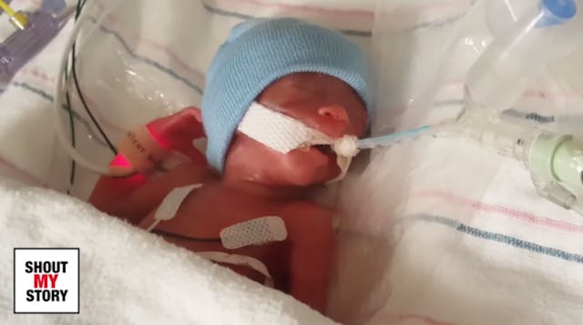 Born at 22 weeks, Thomas is one of the youngest babies ever to survive image