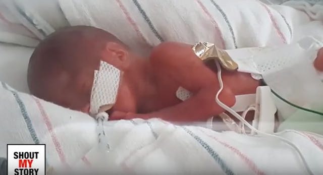 Screenshot: Shout My Story premature baby Thomas