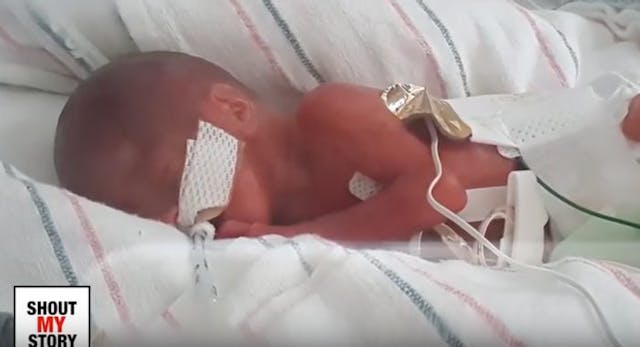 premature baby Thomas