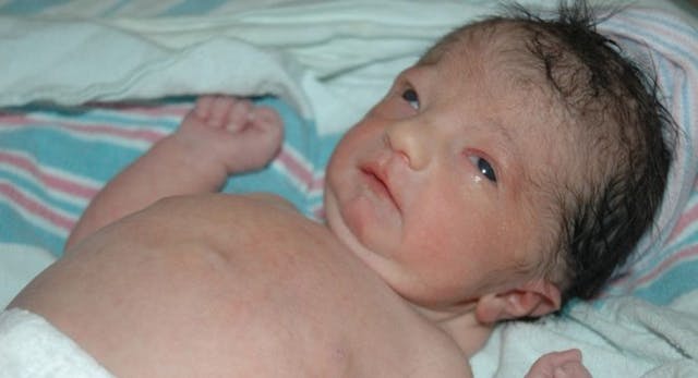 Faith was diagnosed with Trisomy 18 and targeted for abortion. Photo courtesy of Smith family. Trisomy 18, abortion, kids with disabilities