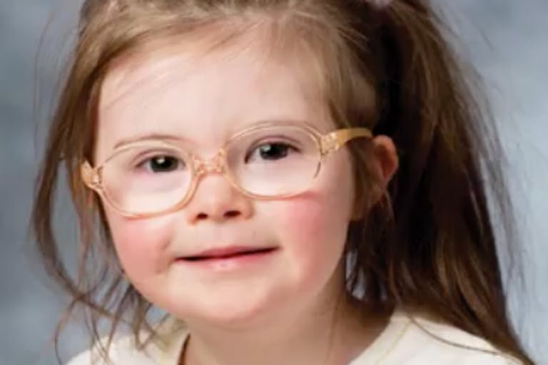 down syndrome campaign