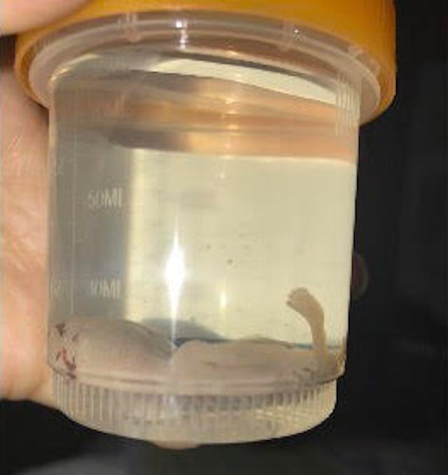 Joshua Jair Zaragosa (Photo: Claudia Zaragosa) miscarried
