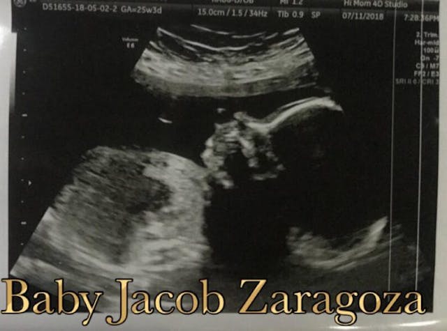 Our son, miscarried at 11 weeks, was a human being, not a clump of cells image