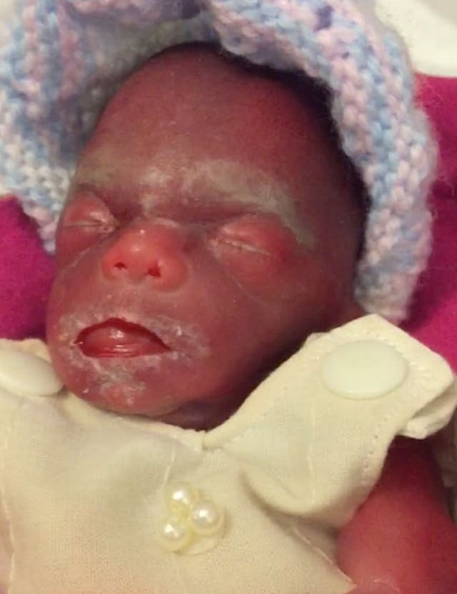 Mom shares moving photos of baby miscarried at 23 weeks: She was ‘so perfect, so beautiful’ image