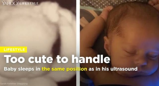 Adorable: Baby sleeps in the same position as in his ultrasound photos image