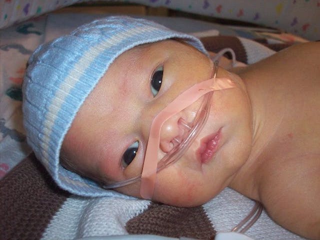 Baby Kyle was born with spina bifida after his parents refused abortion.. Photo courtesy of the Wells family chose life