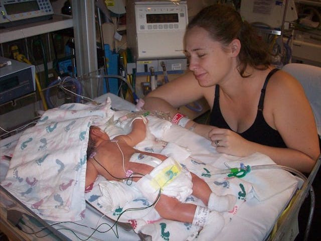 Baby Kyle with his mother. He was born with spina bifida after his parents refused abortion. Photo courtesy of the Wells family chose life