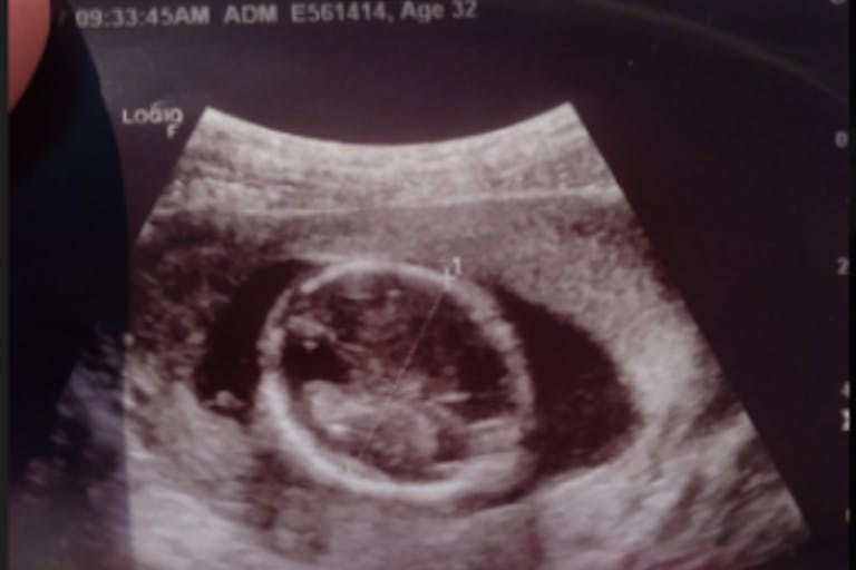 abortion, Planned Parenthood