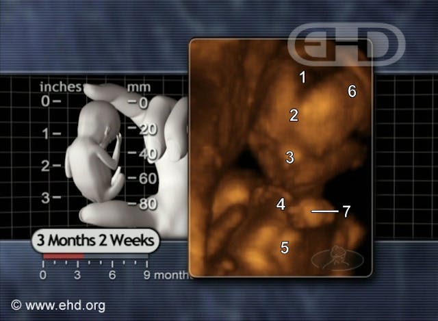 Abortion worker pressured by other workers to abort her wanted baby image