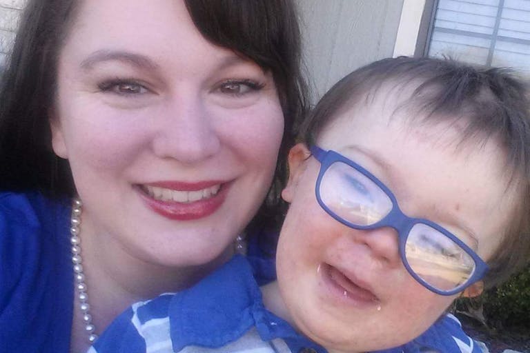 down syndrome