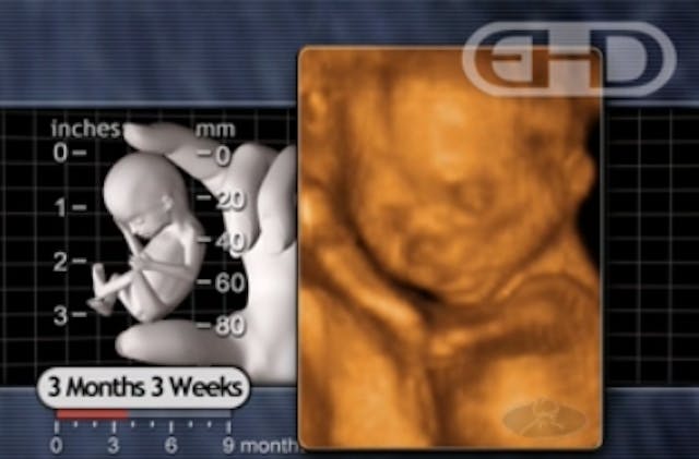 Abortion worker pressured by other workers to abort her wanted baby image