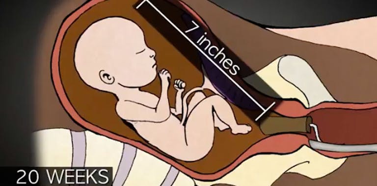 20-weeks