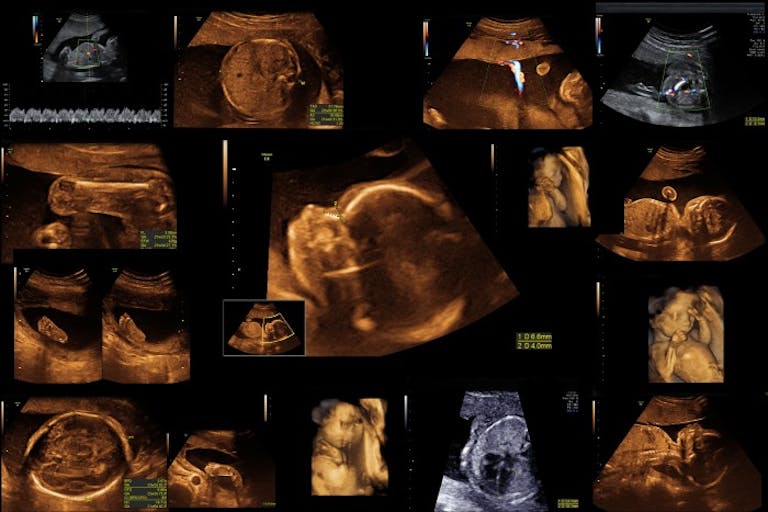 ultrasounds