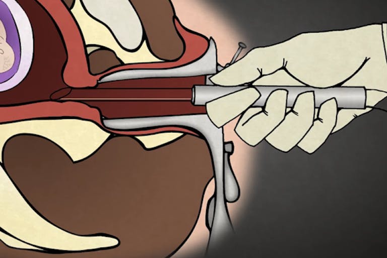 Screen shot 2017-03-06 at 1.59.42 PM