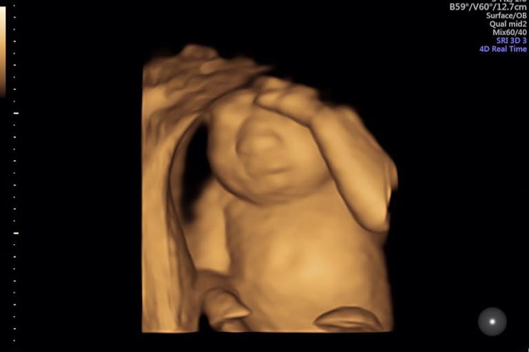 16681979_10104872281321067_7728440848048064254_n