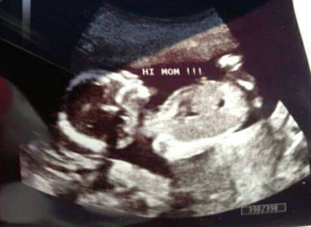 Planned Parenthood deceives woman considering abortion, breaks informed consent law image