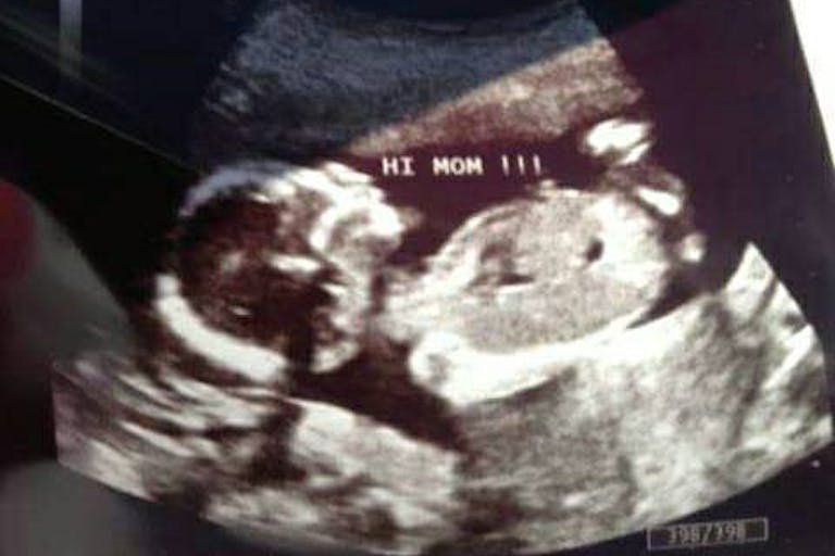 Planned Parenthood deceives woman considering abortion, breaks informed consent law image